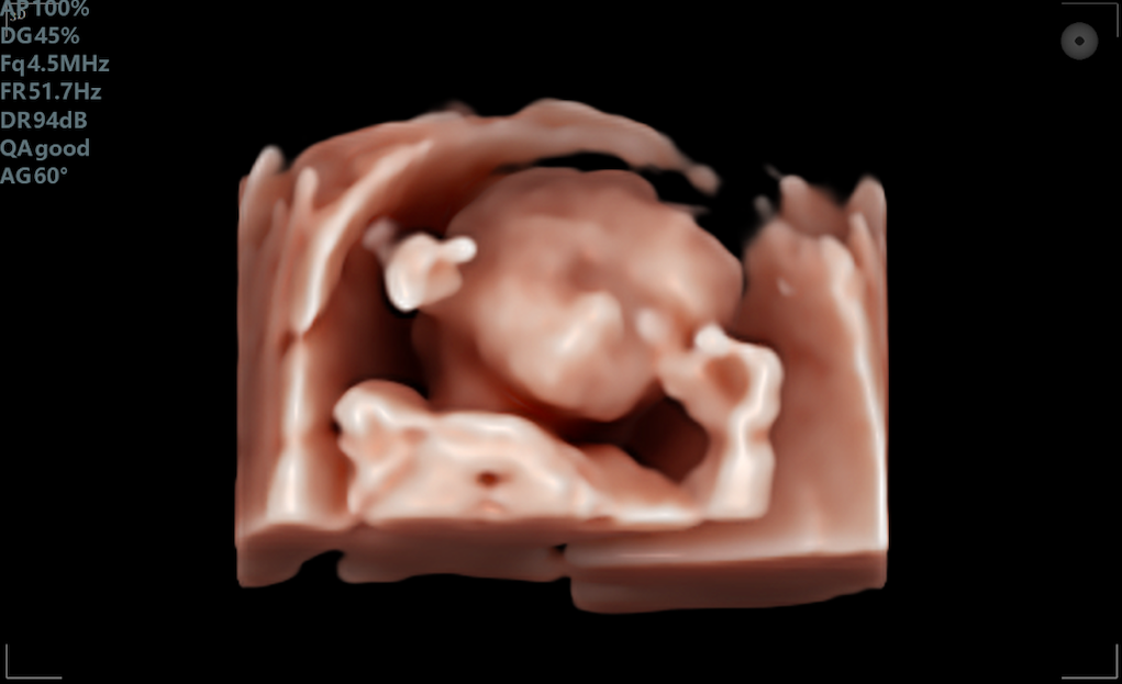 My First Baby Pictures 3D/4D Mobile Baby Ultrasound
